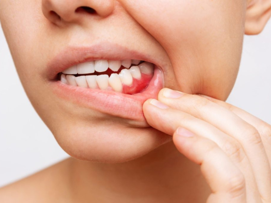 Maplewood Dental Associaties