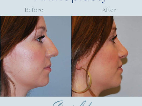 Specialists in Plastic Surgery