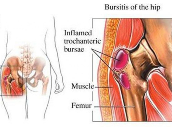 Hip Pain Treatment in Hackensack, NJ