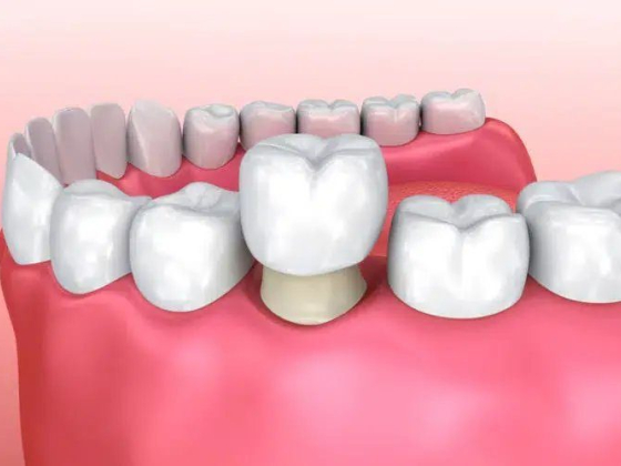 Rocky Ridge Dental