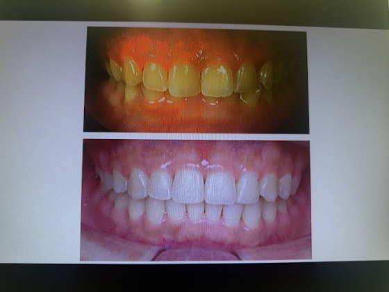 Fresh Dental Care | Dental Clinic Kepong 甲洞牙医诊所