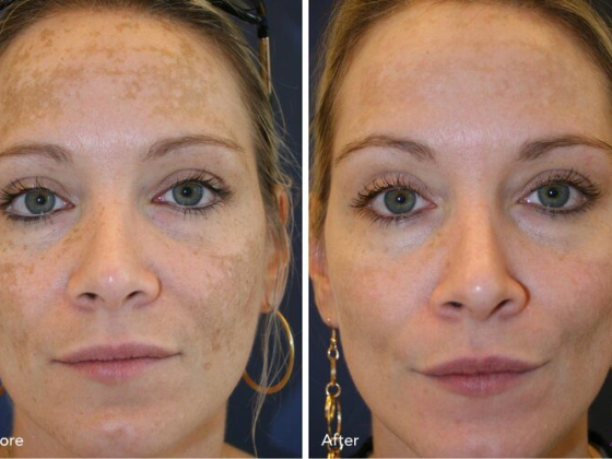 Total Skin and Wellness - North Carolina Med Spa