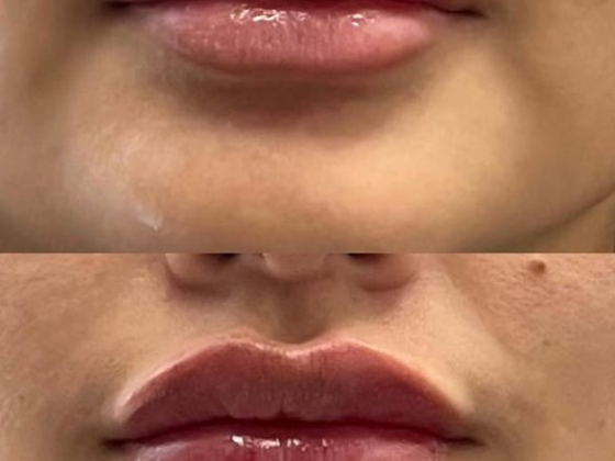 bellaboxx aesthetics