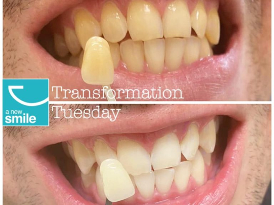 A New Smile Dental Center