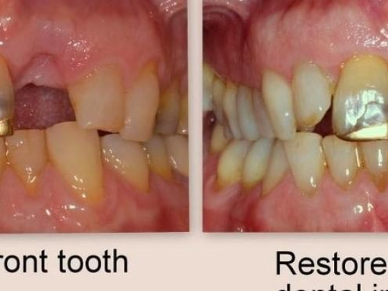 Putney Dental Care