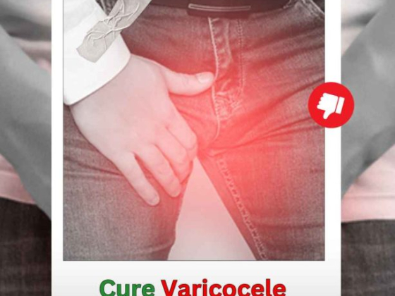 varicocele natural treatment