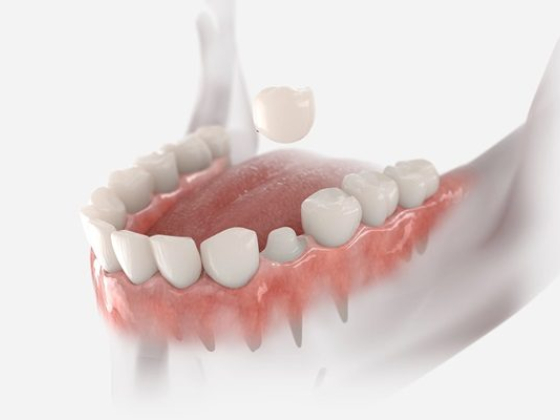 State Street Dental Springfield