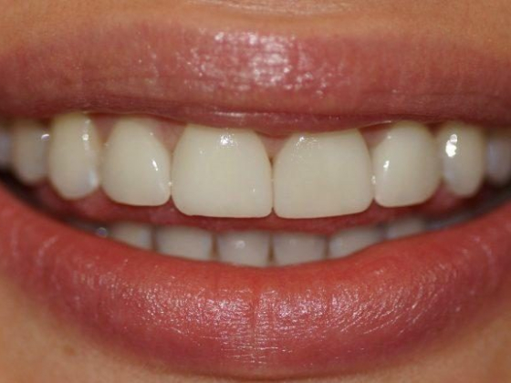Cosmetic Dentistry South Melbourne