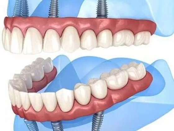 Top Smile Design