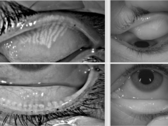 Dry Eye Directory
