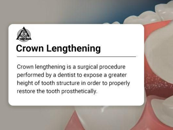 Crown Lengthening in Astoria, Queens