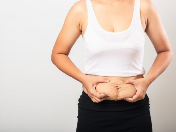 Tummy Tuck Surgery in New Jersey