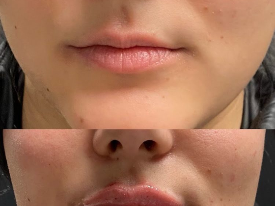 You Aesthetics - Medical Spa