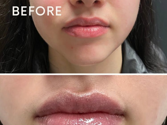 You Aesthetics - Medical Spa