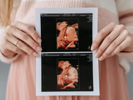 3D 4D 5D Baby Ultrasound Studio