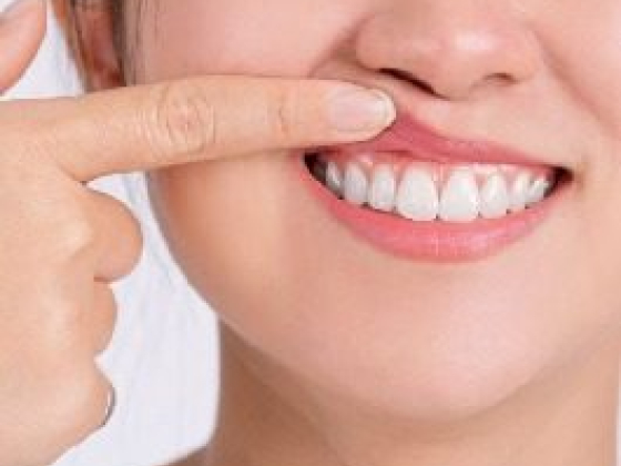 Person pointing to healthy gums and teeth