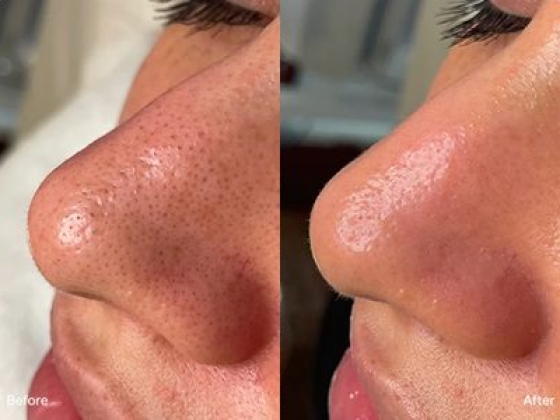 La Beauty Boutique | Medical Spa & Skincare Clinic