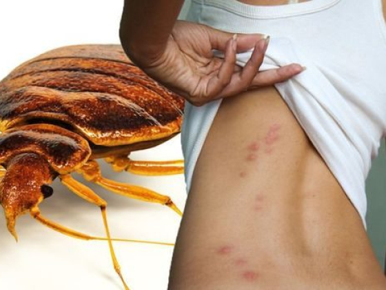 Bed bug image and skin with bite marks