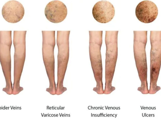 Elite Vein Clinic of Ahwatukee Foothills